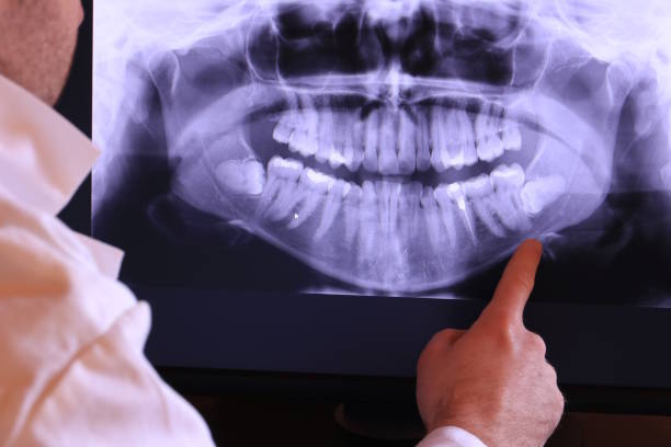 Best Emergency Treatment for Toothache in Midvale, UT